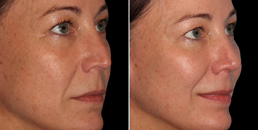 Plastic Surgery Results
